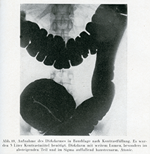 X-ray image of the large intestine